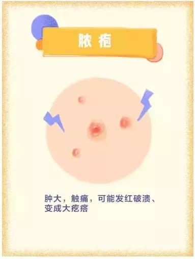 怎么去除脸上痘印痘坑痘痕,预防痘坑买什么