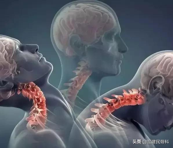 不花一分钱轻松治颈椎小学生,麦肯基颈椎治疗法真的有用