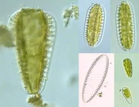 鱼类水产养殖需要哪些藻类,水产养殖显微镜下各种藻类
