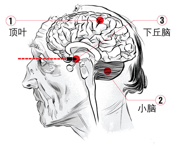 僵尸生存指南,僵尸生存的攻略