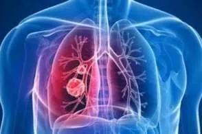 2020新冠状病毒考试题库,2020年新型冠状病毒知识题库