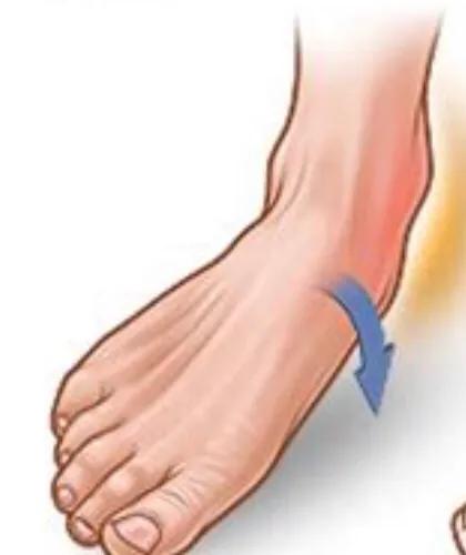 崴脚了要怎么自救,脚崴了一个月了该怎么办