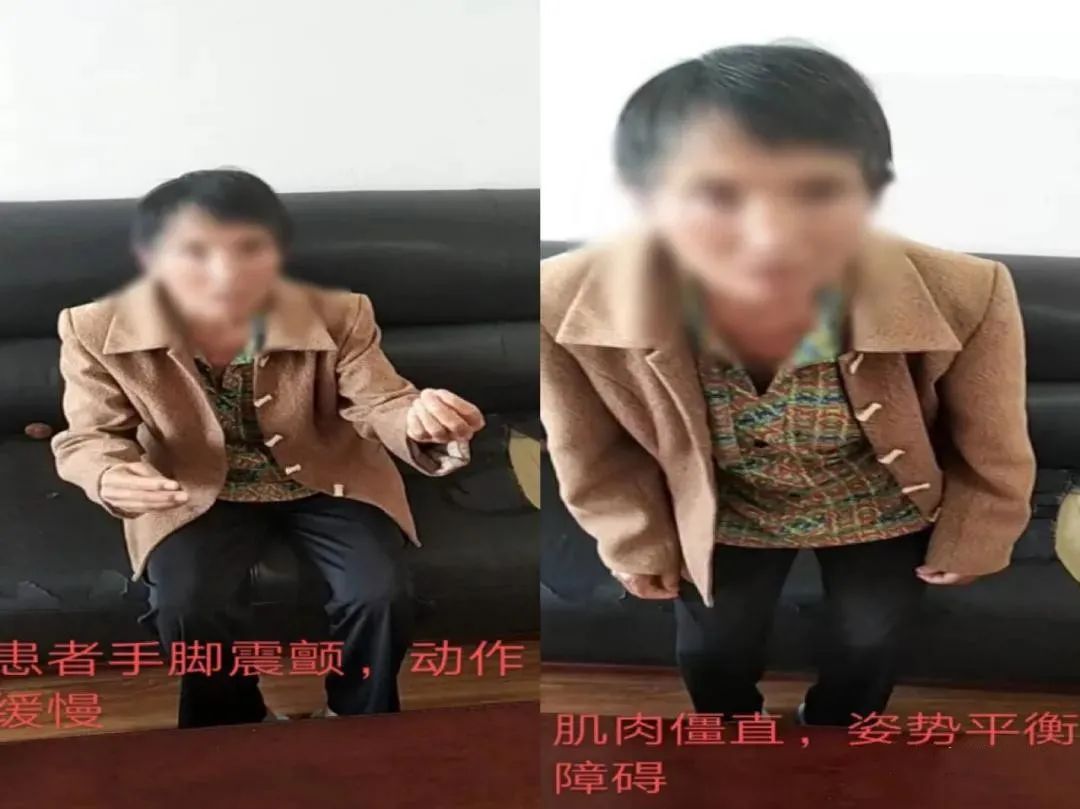 大理帕金森治疗,大理州第一人民医院新院区