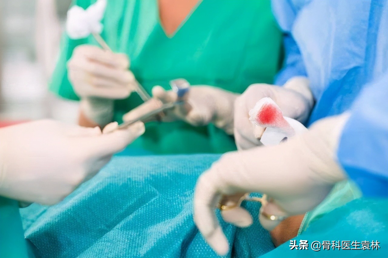 如何治疗骨质增生膝盖疼,骨质增生膝盖痛怎么治疗