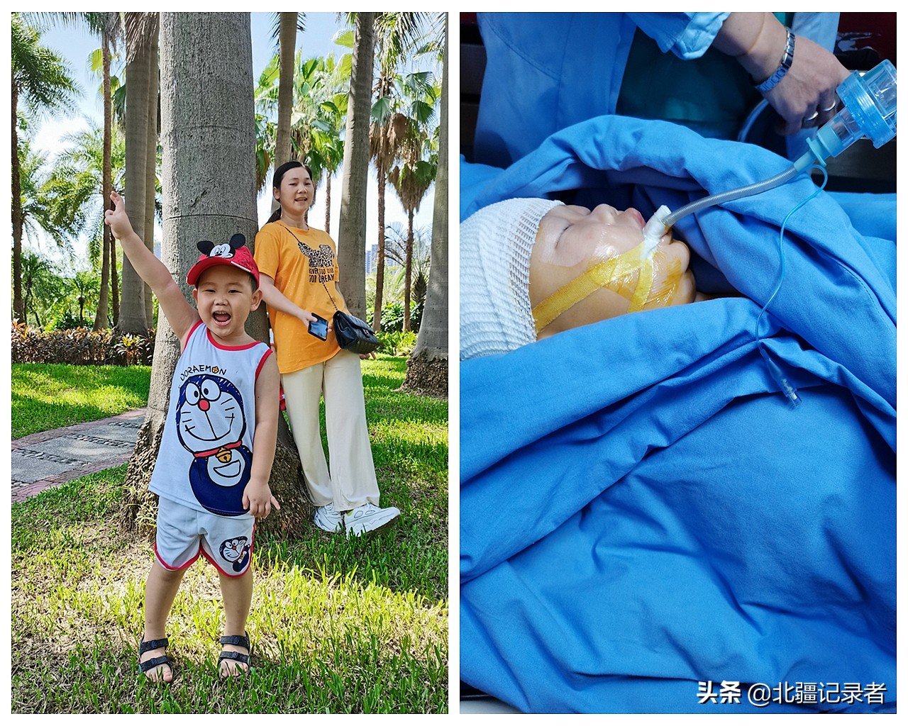 小孩咳嗽厉害突然死亡,孩子因为支气管肺炎住院的视频