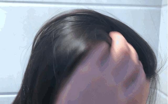 头发发质很蓬松而且很毛躁 (头发稀少不蓬松出油还厉害)