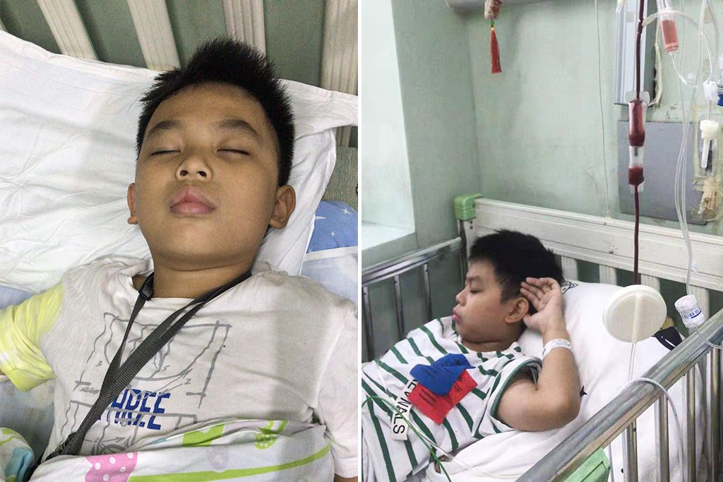 八岁男孩腋下好多红疙瘩,小朋友腋下有一片红疙瘩