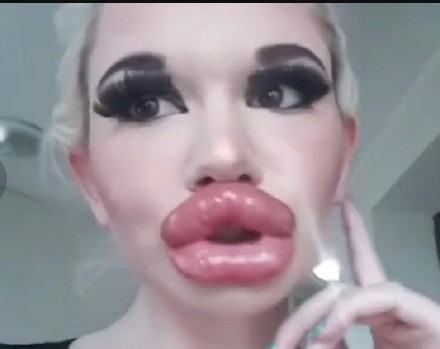 世界上最好看的嘴唇形状,世界最厚嘴唇的人嘴唇往外翻