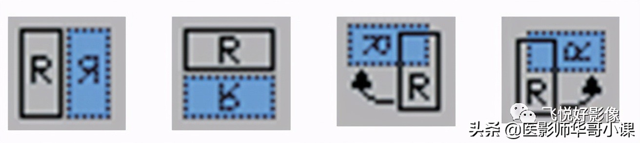 飞利浦磁共振波谱成像扫描技术,飞利浦磁共振纵隔扫描技术