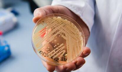 死亡率高达50%的病毒,中国有多少人感染超级真菌