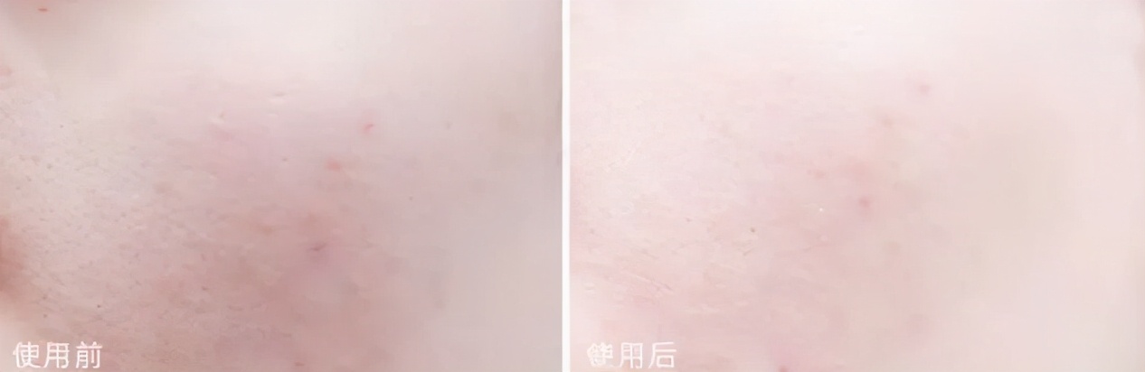 均价2元的面膜,2-3块钱一片的面膜推荐