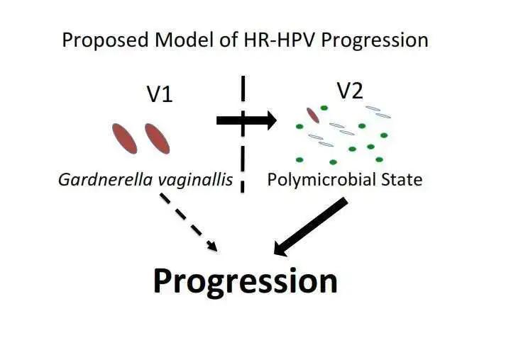 不检查hpv能直接打宫颈癌疫苗吗,用不用去查hpv