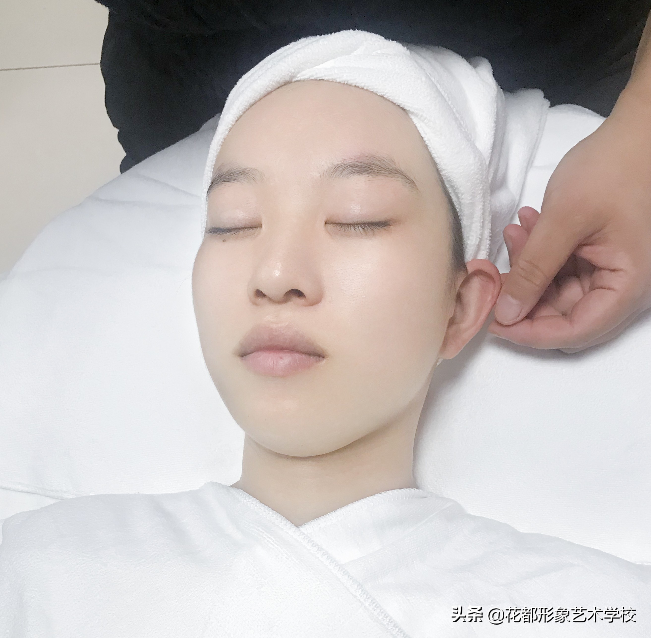 改善干纹细纹松弛下垂毛孔粗大,皮肤毛孔粗大皮肤松弛下垂怎么办