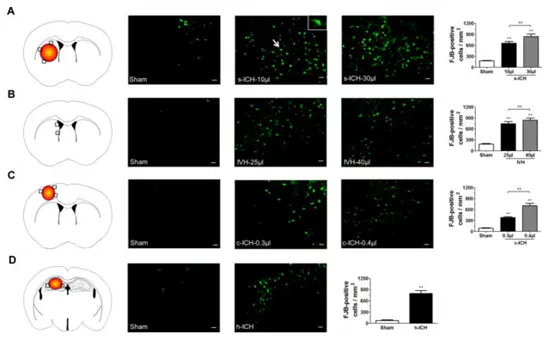 干细胞治疗脑卒中后遗症的新药,日本神经干细胞治疗脑出血后遗症