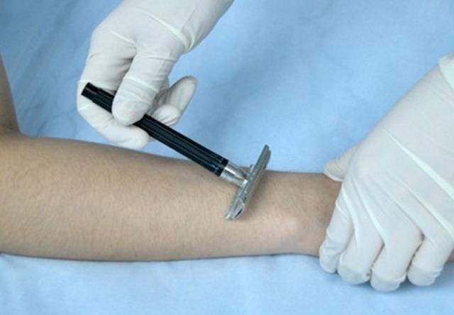 生宝宝要处理毛发吗,生孩子要刮头发吗