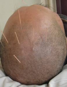 为何我长得这么帅却要掉头发,为何我长得这么帅但要掉头发gif