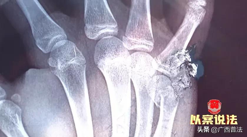 孩子在午托班被打了怎么赔偿,孩子在午托班打闹受伤谁的责任