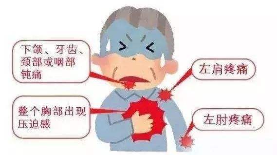 没有诱因的胸痛会是冠心病吗,冠心病胸痛要警惕