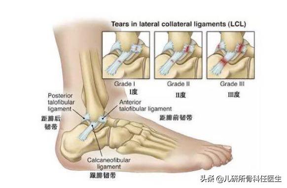 小孩脚踝麻麻的感觉怎么了,小孩常见的脚踝问题