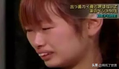 石原里美和佐藤健,石原里美整容之路