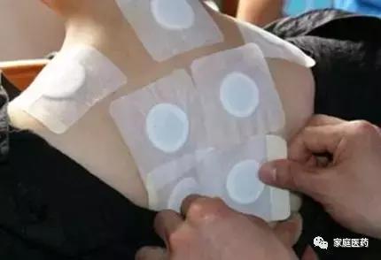 关节损伤贴什么膏药,胸锁关节损伤贴什么膏药