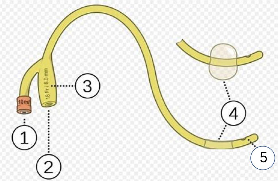 长期留置尿管，需要关注哪些方面，医生告诉你