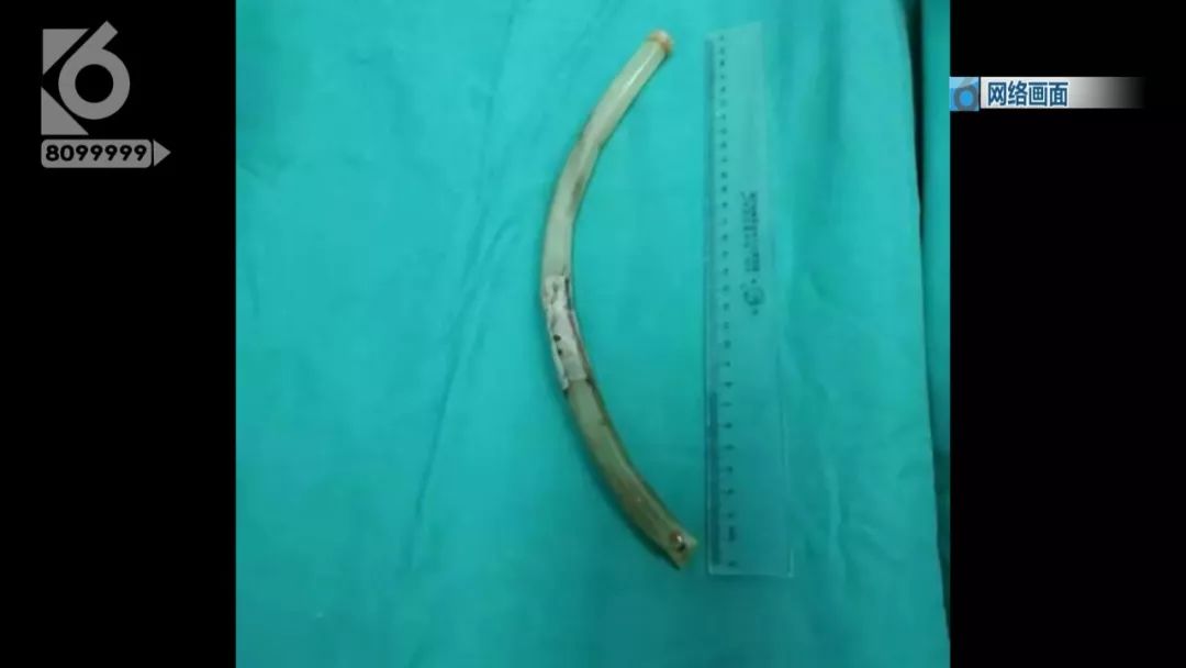 为了瘦就要放弃美食,为了瘦而丢掉性命