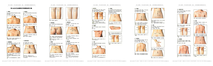 风寒咳嗽的艾灸治疗,风寒咳嗽艾灸哪个穴位可以止咳