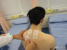 艾灸专家讲艾灸疗效,在家艾灸哪种灸法效果最好