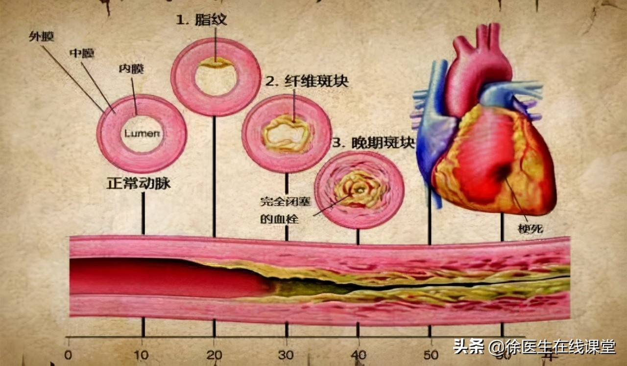 肝硬化食道胃底静脉曲张破裂出血,肝硬化消化道出血静脉曲张的治疗