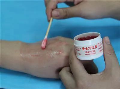 庞医生妇科,庞医生说中医治妇科炎症