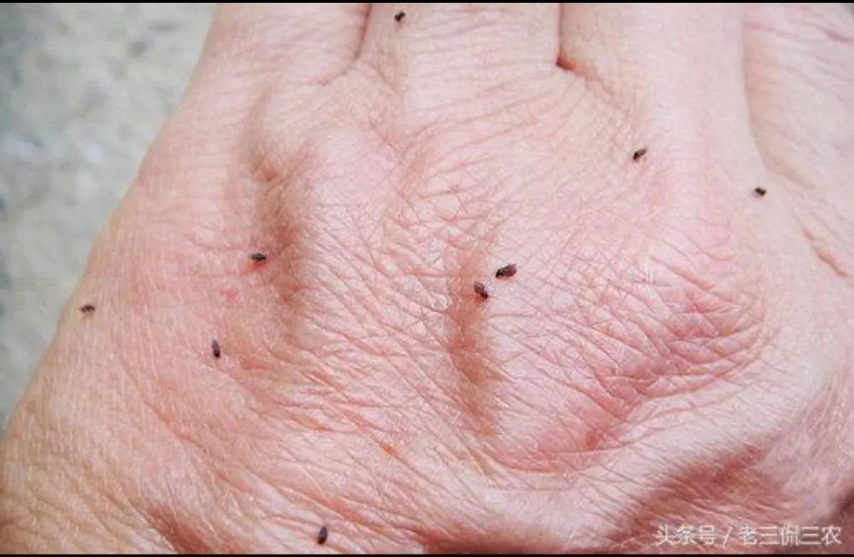 四川墨蚊咬了用什么药,被墨蚊咬了图片