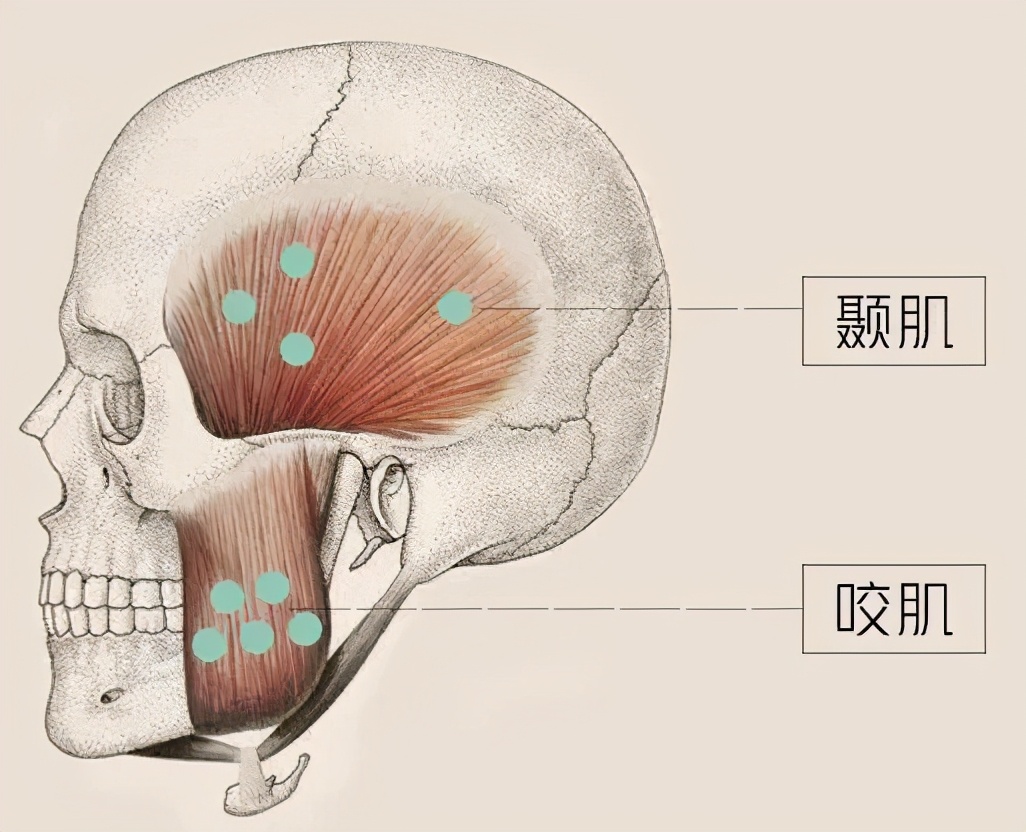 改善太阳穴脸颊凹陷的修容,改善太阳穴凹陷的面部动作