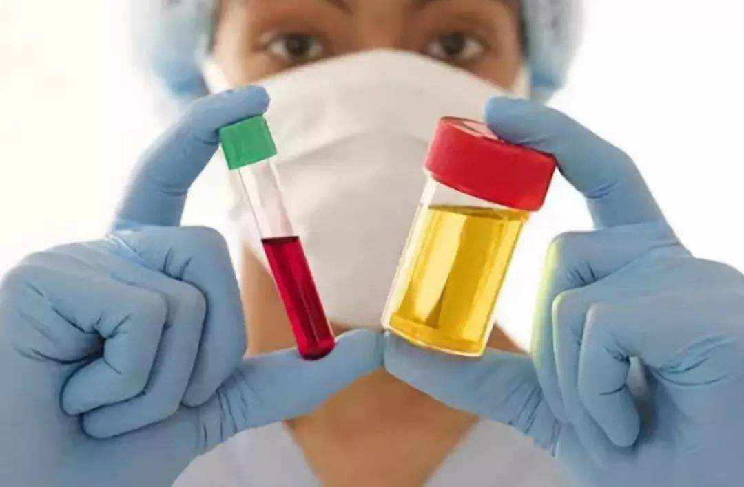 世界最新痛风药,加拿大治疗痛风的药好用吗