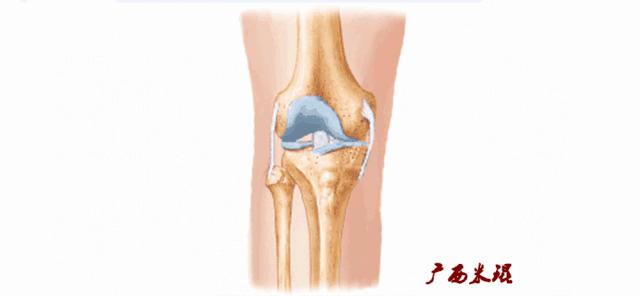前交叉韧带扭伤最快自愈方法,前交叉韧带损伤膝关节会疼吗