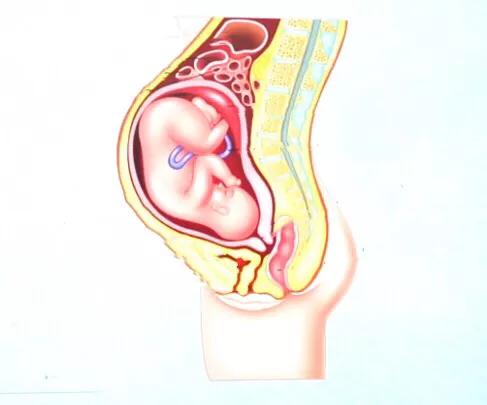 产后臀肥大怎么瘦,产后屁股变大怎么瘦下来