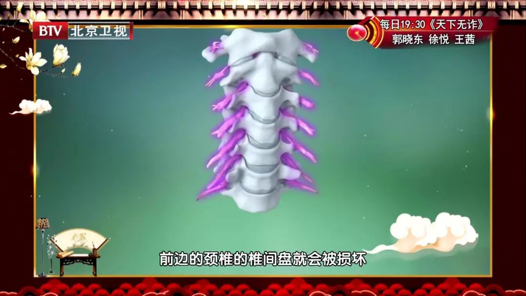 颈动脉有斑块五个办法解决,颈动脉斑块怎么办应该注意什么