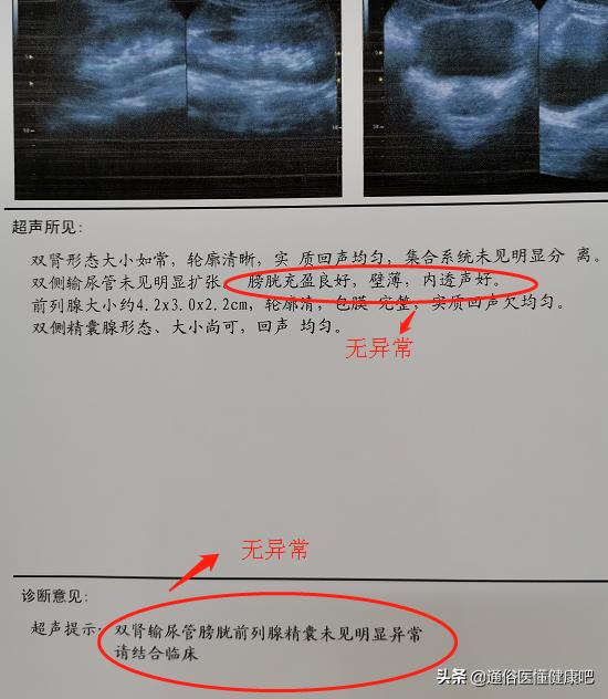 少年血尿是什么原因引起的,少年血尿是怎么回事