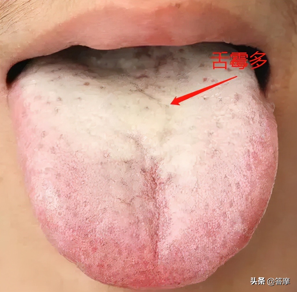 舌象脏腑图,体内有湿寒的舌象