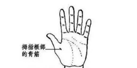 手背青筋明显是血管硬化的表现吗,血管有问题看哪个科