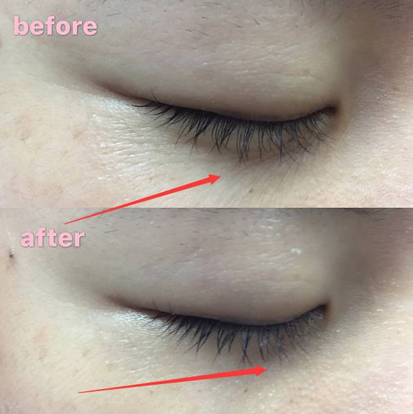 张馨予超爱的品牌！99元的眼霜，就能改善黑眼圈、干纹！