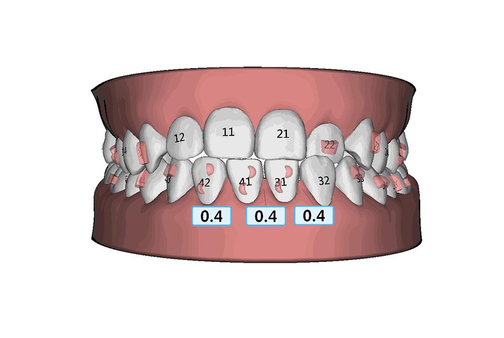 牙科的一些常识,牙科常见的问题和治疗方法