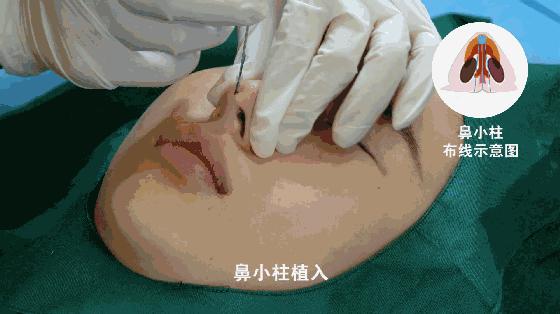 整容也就图一乐,真投胎还得买神水