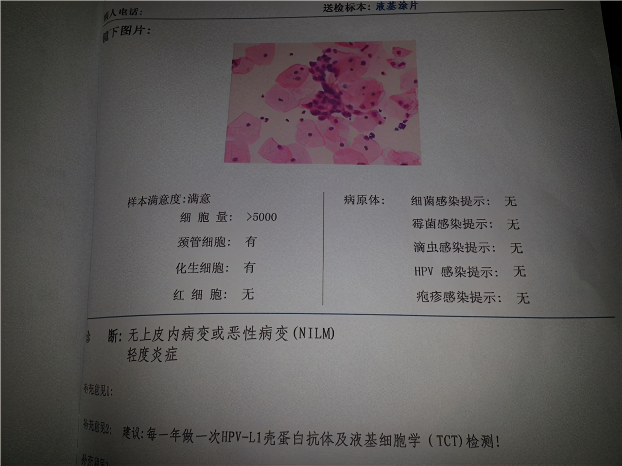 霉菌性阴道炎一般不能自愈，但可通过药物治愈，平时多注意这几点