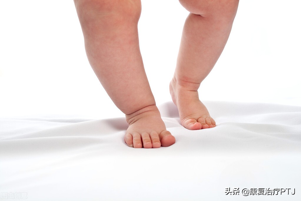 下肢力线异常表现,下肢力线有必要纠正吗