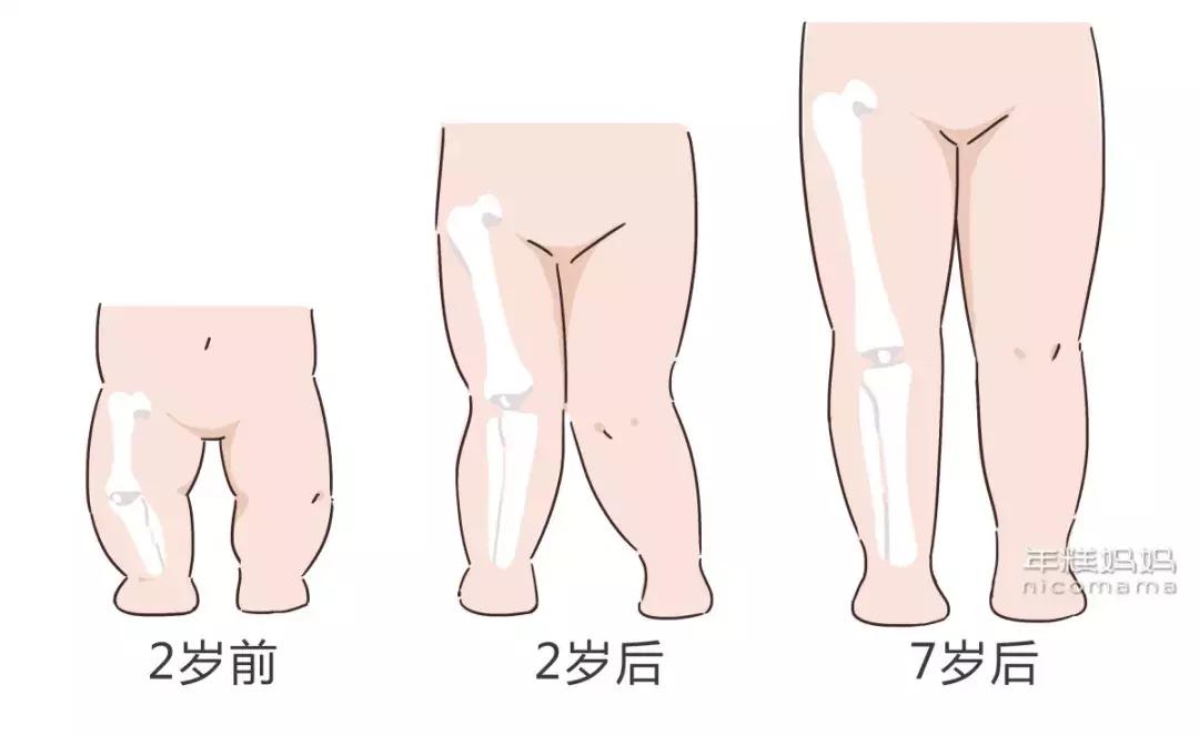 如果你想坑了孩子，就给他穿这2种鞋吧，以后肯定是个脚畸形的娃