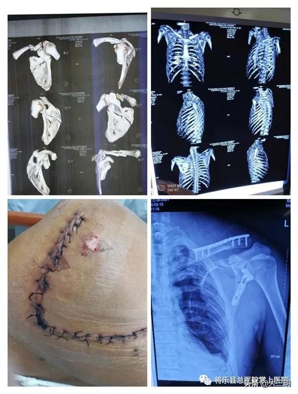 急危重症抢救医护协作,医院急诊抢救危重病人
