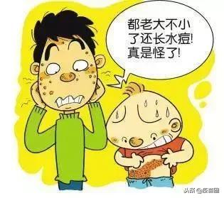 水痘高发期间谨记战痘三大招,水痘高发期战痘防护要做好
