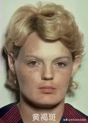 为什么用美白精华皮肤变白,为什么用了美白护肤品反而变黑了