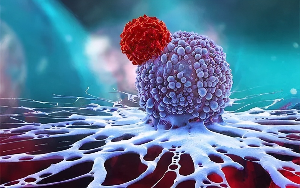 宫颈癌复发用什么药好使,宫颈癌复发的患者可选用的方案是